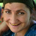 жена със златни зъби