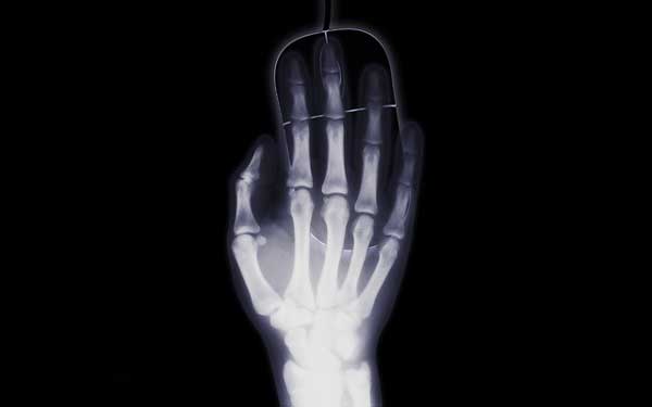 ръка-на-рентгенова-снимка