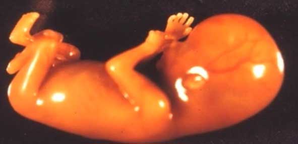  ембрион-аборт 